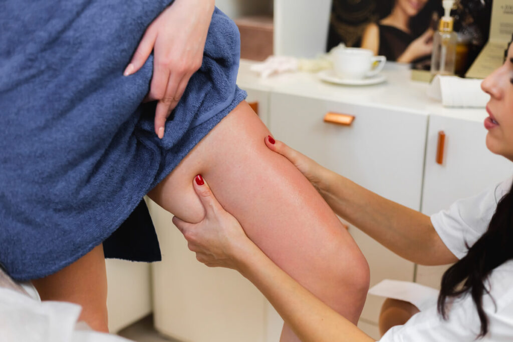 Bleu après une épilation à la cire : causes et que faire 3